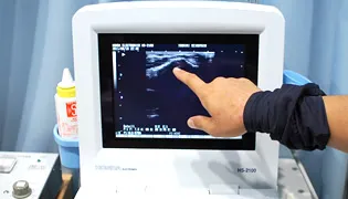 超音波画像診断